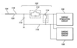 MRI signal filtering for implantable medical device