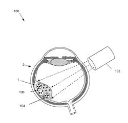 ULTRASOUND AND MICROBUBBLES IN OCULAR DIAGNOSTICS AND THERAPIES