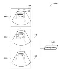 System and method for identifying an optimal image frame for ultrasound imaging