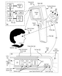 Video otoscanner with line-of-sight probe and screen