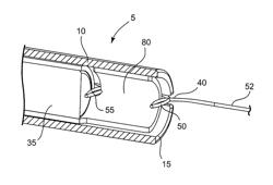 Knot pusher device