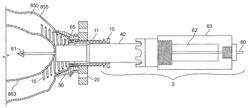 CONDUIT DEVICE AND SYSTEM FOR IMPLANTING A CONDUIT DEVICE IN A TISSUE WALL