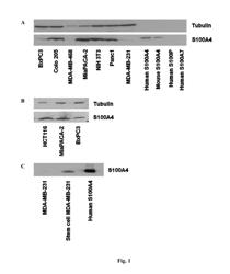 S100A4 antibodies and therapeutic uses thereof