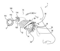 Systems and methods for treatment of dry eye