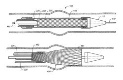 Endovascular delivery system having textile component for implant restraint and delivery