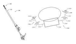 Methods and devices for reconfiguring a body organ