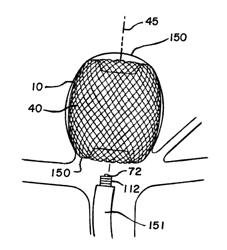 DELIVERY AND DETACHMENT SYSTEMS AND METHODS FOR VASCULAR IMPLANTS