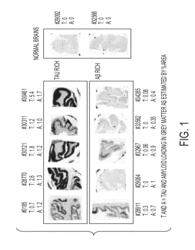 Imaging agents for detecting neurological dysfunction