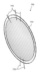 Stacked Membrane Bioreactor