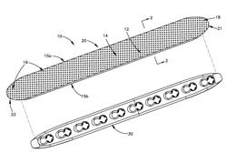 Drug-Impregnated Encasement