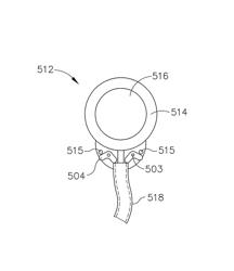 Implantable medical port with alignment feature