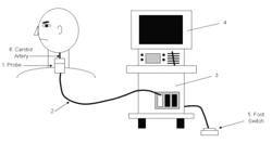 Ultrasonograph and method of diagnosis using same