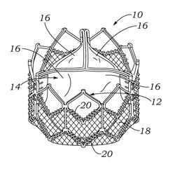 Encapsulated heart valve