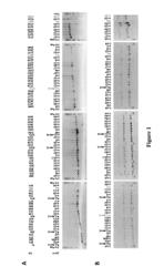 Methods and Compositions Of Protein Antigens For The Diagnosis And Treatment of Herpes Simplex Viruses Type 1 and 2