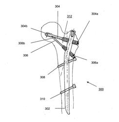 SURGICAL IMPLANT DEVICE, METHOD AND APPARATUS FOR IMPLANTING THEREOF