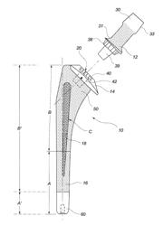 DIFFERENTIAL POROSITY PROSTHETIC HIP SYSTEM