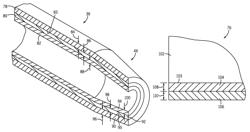 Pulse detonation system