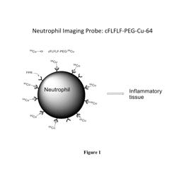 COMPOSITIONS AND METHODS FOR IMAGING INFLAMMATION OF TRAUMATIC BRAIN INJURY