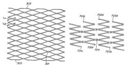 Controlled fracture connections for stents