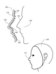 SYSTEMS, METHODS, AND DEVICES FOR ASSESSING MICROBIOTA OF SKIN