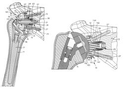 Glenoid support for shoulder prosthesis