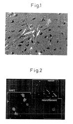 Neural precursor cells produced from bone marrow stromal cells containing an exogenous nucleic acid encoding a notch intracellular domain (NICD)