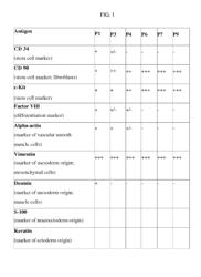 USE OF ADIPOSE TISSUE-DERIVED STROMAL STEM CELLS IN TREATING FISTULA