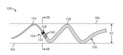 Intravascular Neuromodulation Device Having a Spiral Track and Associated Methods