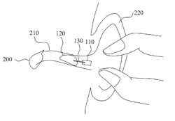 HEARING LOSS COMPENSATION APPARATUS INCLUDING EXTERNAL MICROPHONE