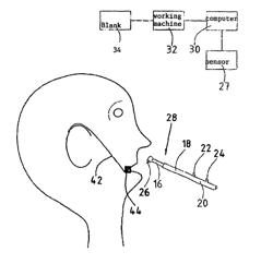 Method for determining 3-D data from at least one prepared maxillary area