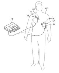 Pulse detection using patient physiological signals