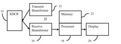 Shear Wave Detection in Medical Ultrasound Imaging