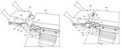 Operating table top assemblies and related devices