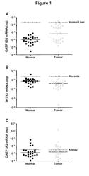 Microcystins as agents for treatment of cancer