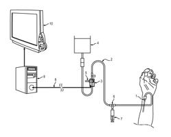 METHOD AND DEVICE FOR MONITORING BLOOD PRESSURE MEASUREMENT BY ARTERIAL CATHETERIZATION OF A PATIENT