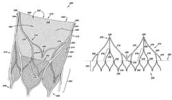 Venous valve, system, and method