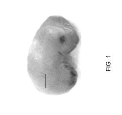 Omentum as a source of stromal/stem cells and medical treatment using stromal/stem cells