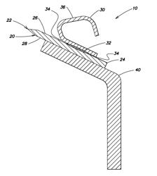 Razor blade technology