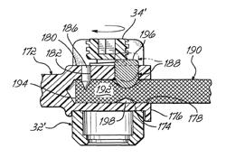 Spinal stabilization system with rigid and flexible elements