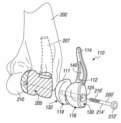 Elbow prosthesis