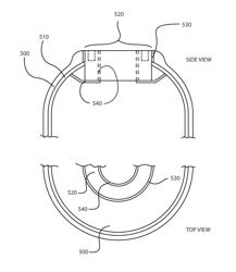 PRESSURE VESSEL WITH COMPOSITE BOSS