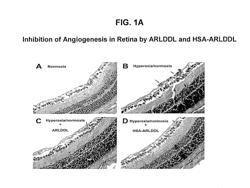 Compositions and methods for the treatment of angiogenesis-related eye diseases