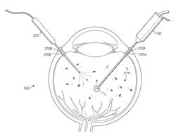 Small diameter fragmatome for minimally traumatic retained lens fragments removal