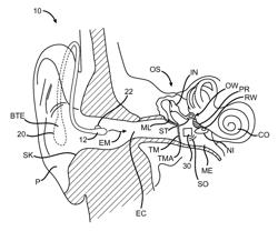 Optically coupled acoustic middle ear implant systems and methods