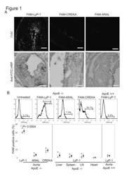 Peptides that home to atherosclerotic plaques and methods of use