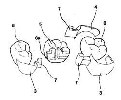 DENTAL PROSTHESIS AND ITS MANUFACTURING METHOD