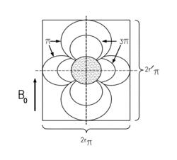 Iron quantification of brain microbleeds