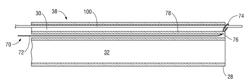 CATHETER SYSTEM