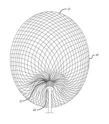 Filamentary devices for treatment of vascular defects