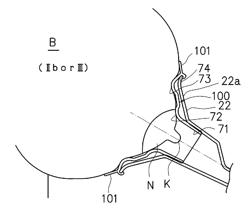 Breast pump